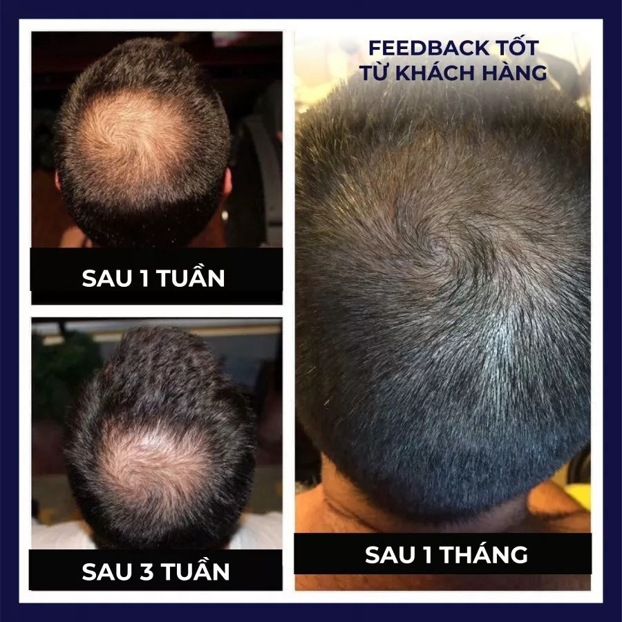 [natural care growth oil ] - [Rukia hair care]