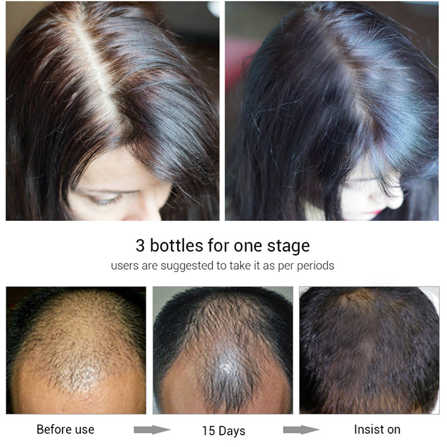 [natural care growth oil ] - [Rukia hair care]