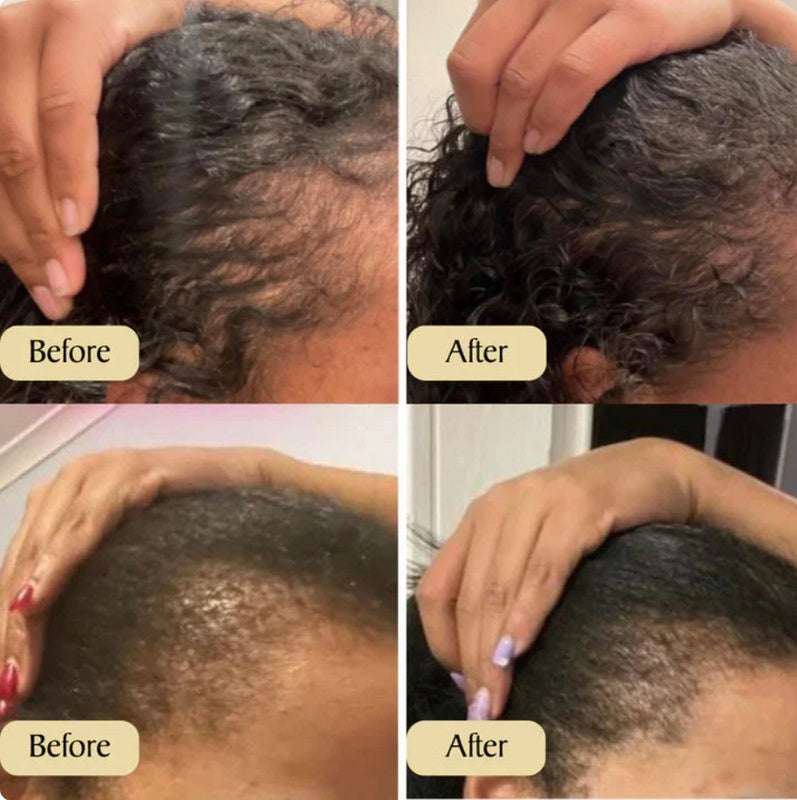 [natural care growth oil ] - [Rukia hair care]