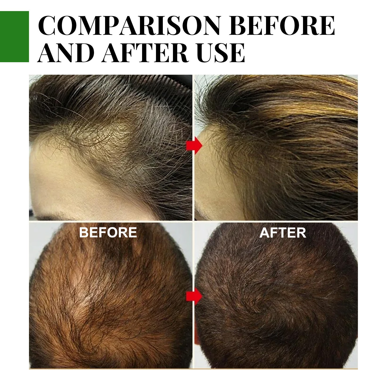 [natural care growth oil ] - [Rukia hair care]